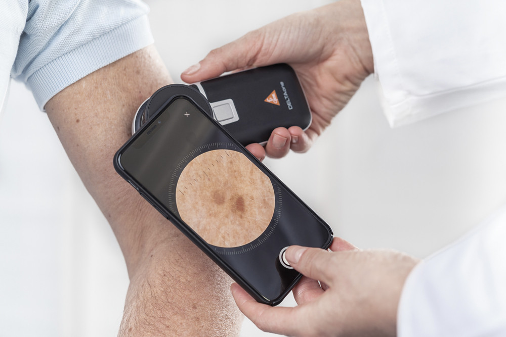 HEINE DeltaONE Dermatoscope